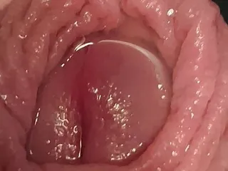 Foreskin close up with alot of piss 