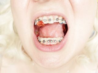 braces fetish: close up video mukbang .