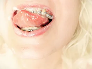 BRACES fetish - ASMR clip of eating MUKBANG...