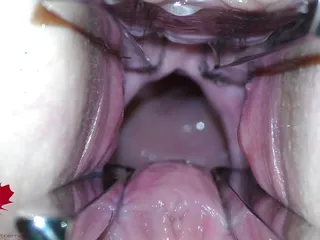 The mistress&#039; cunt is opened with a hole expander so that you can study her cervix.