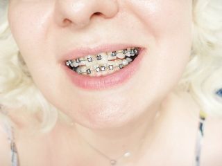 braces fetish: close up video mukbang ..