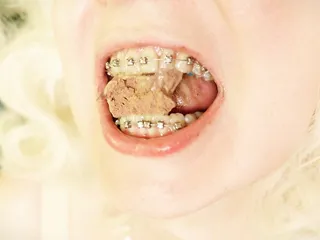 BRACES fetish - ASMR video of eating food MUKBANG...
