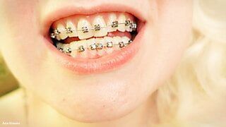 braces mouth tour video - vore fetish
