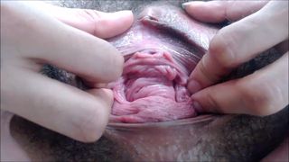 Pervert Files: 18yo Prolapsed Hairy Cunt Meat