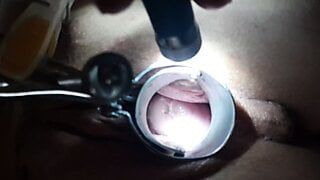 Speculum play in my pussy