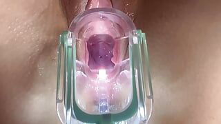 Stella St. Rose - Extreme Gaping, See my Cervix Close-Up using a Speculum
