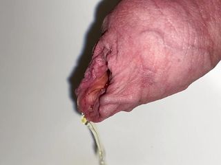 Foreskin Pissing And Cumshot