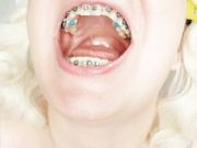 braces fetish: close up video mukbang 