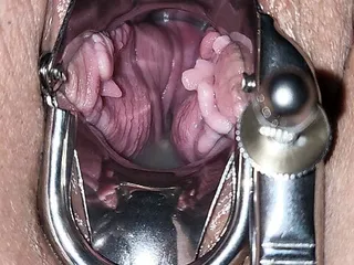 Camera Inside Vagina, Amateur BBW, Sexy Pussy, Mollige 28