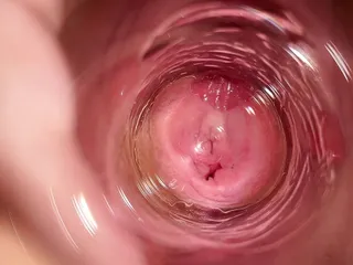 Camera deep inside Mias vagina