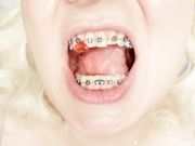 braces fetish: close up video mukbang .