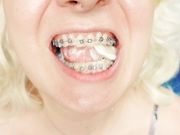 braces fetish: close up video mukbang ...