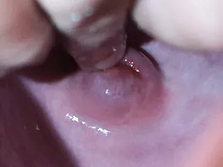 Cervix Play, 18 Years Old, Close up, Fun