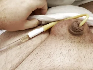 BBW with small dick with bladder catheter and swollen balls: he cums a lot!
