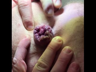 Small prolapse and anal play...