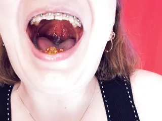 Chewing, HD Videos, FapHouse, Braces Fetish